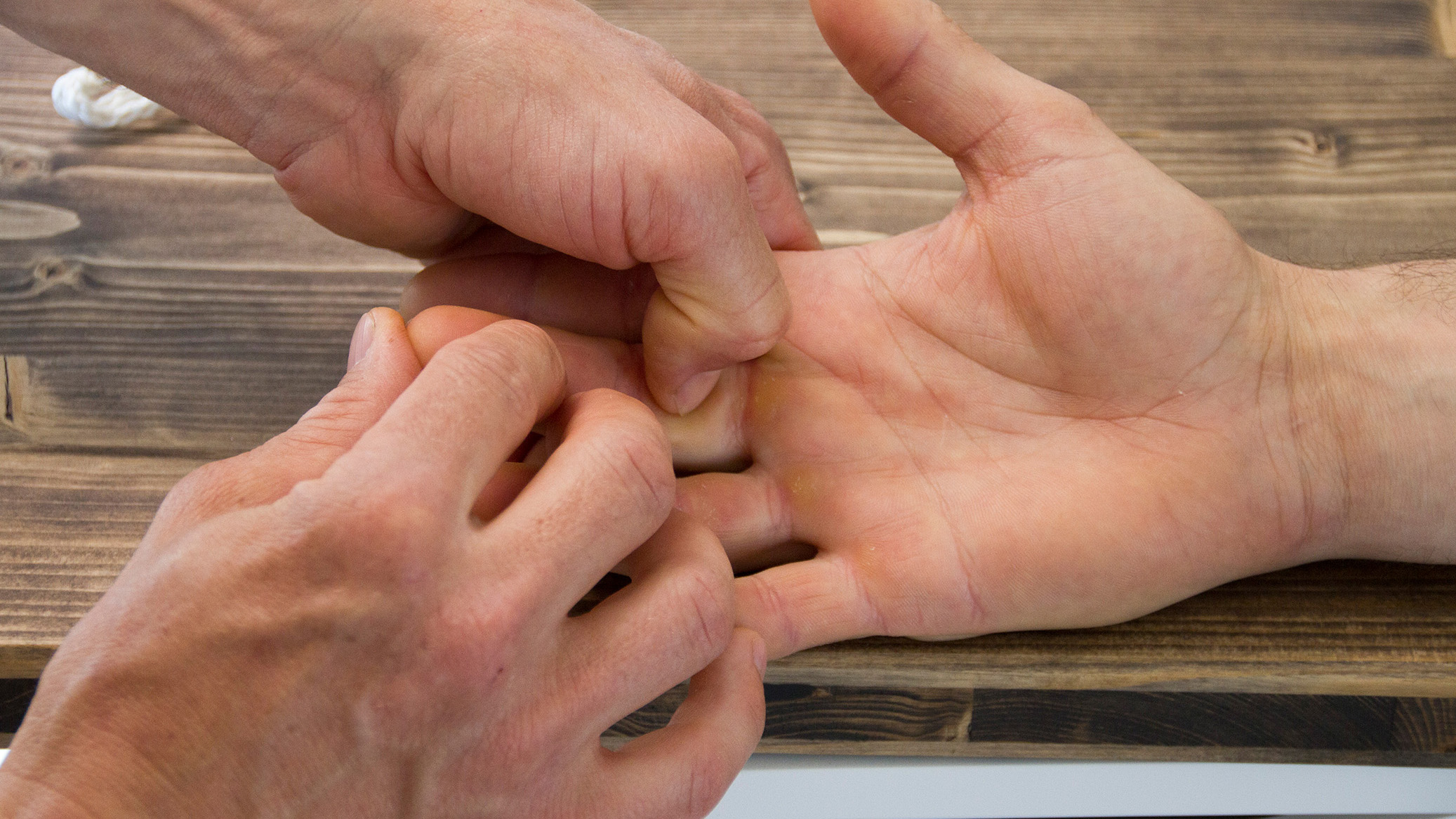 Handtherapie